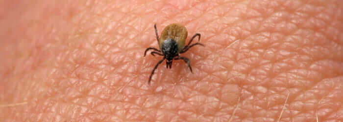 Lymes disease tick bite